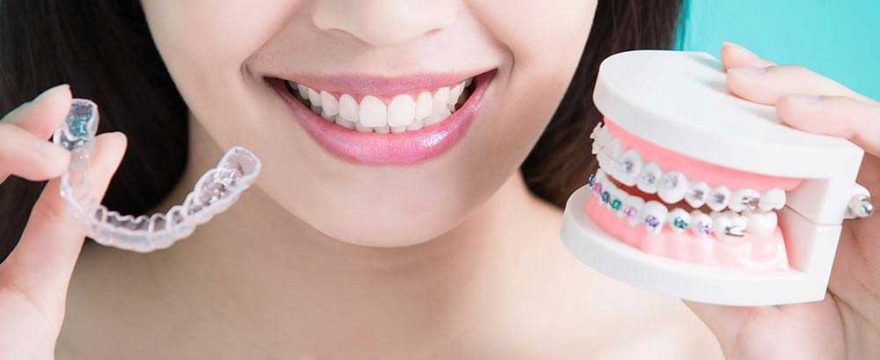 Braces & Aligners