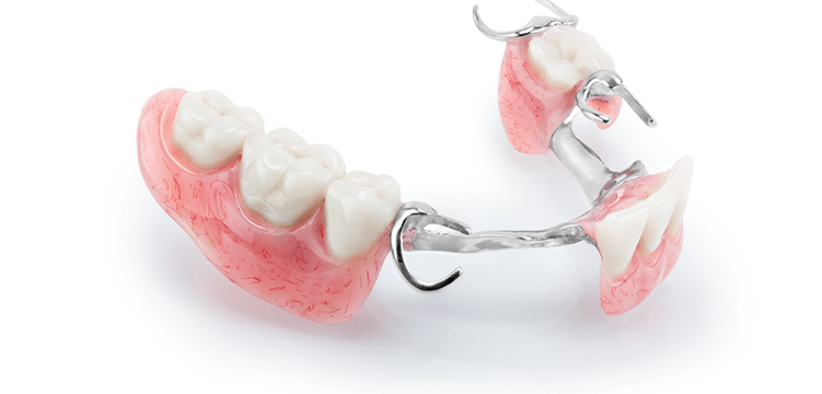 Types of Partial Dentures To Consider